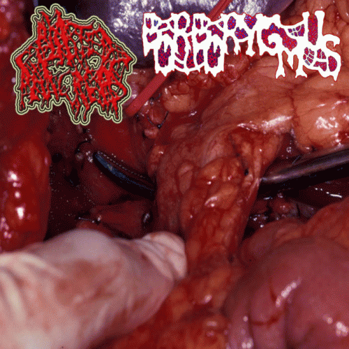 Borborygmus : Blasted Pancreas - Borborygmus
